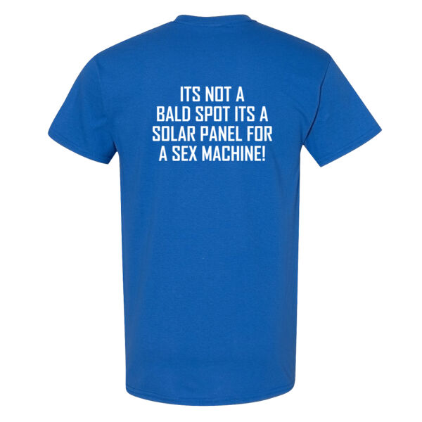 It's Not a Bald Spot Thumbnail